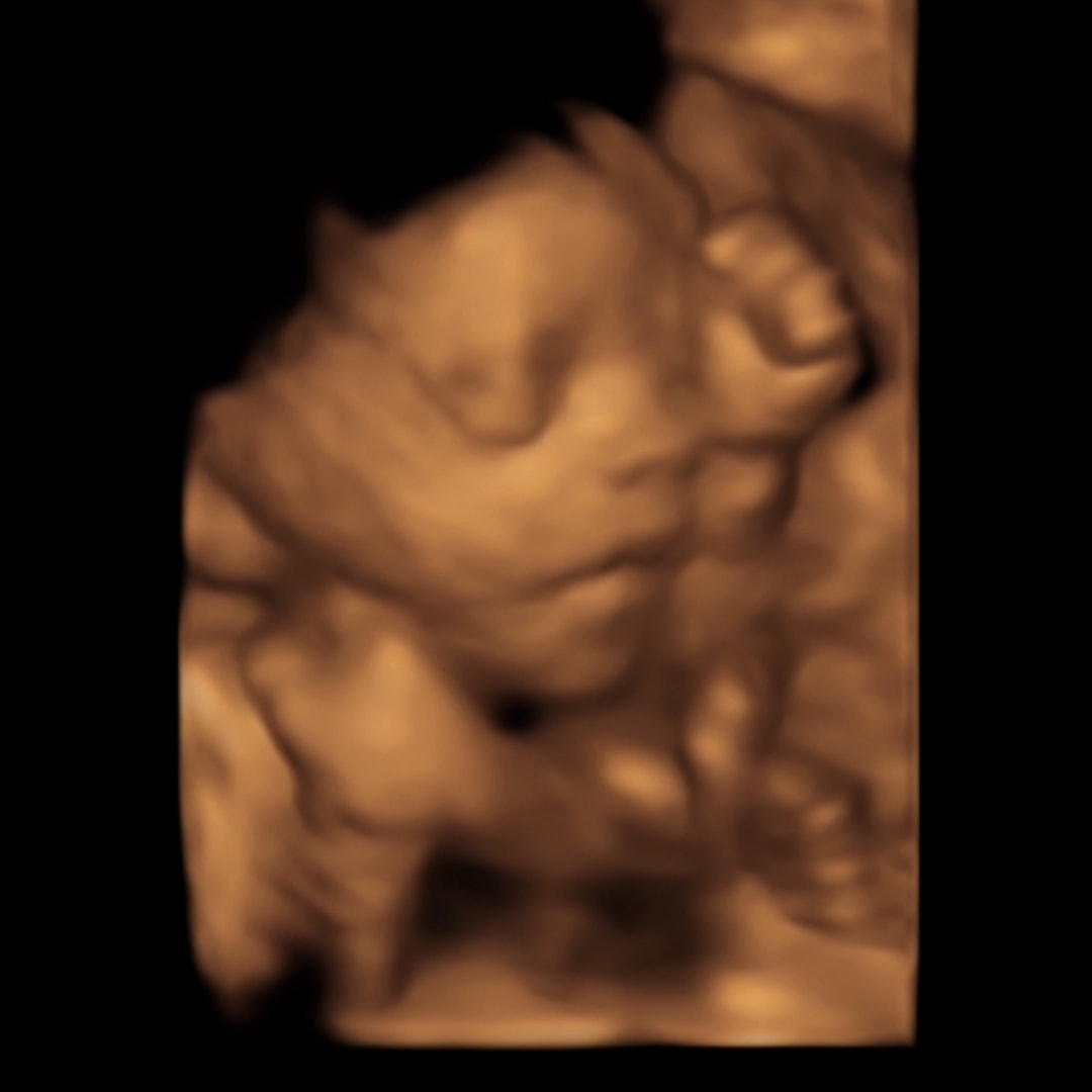 Photo shared by Amya for their Babylist baby registry.