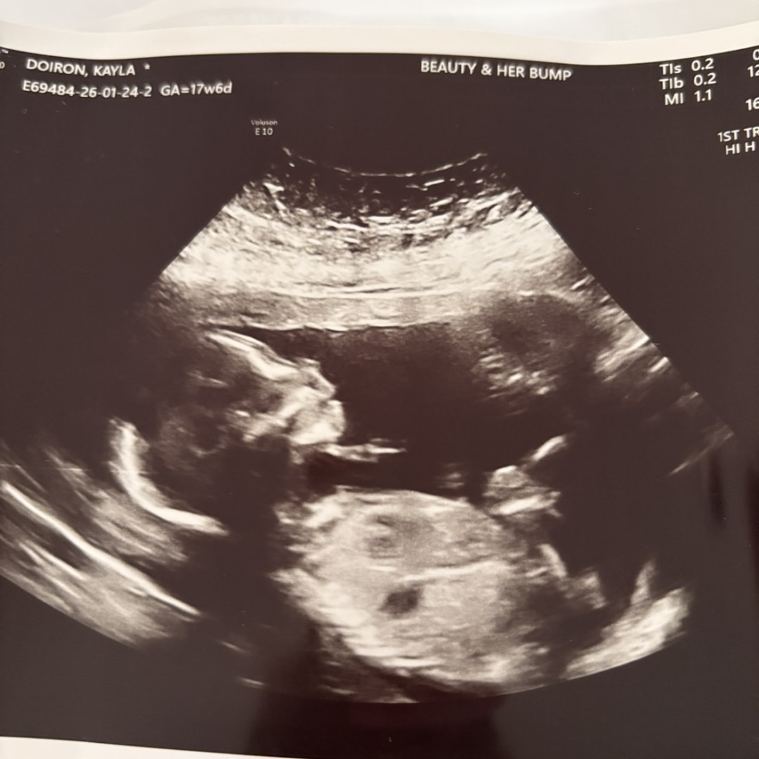 Photo shared by Kayla for their Babylist baby registry.