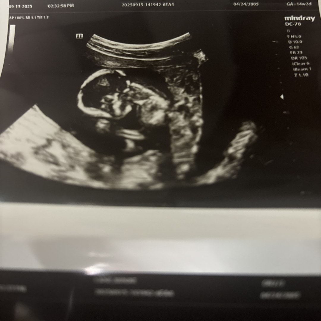 Photo shared by Minae for their Babylist baby registry.