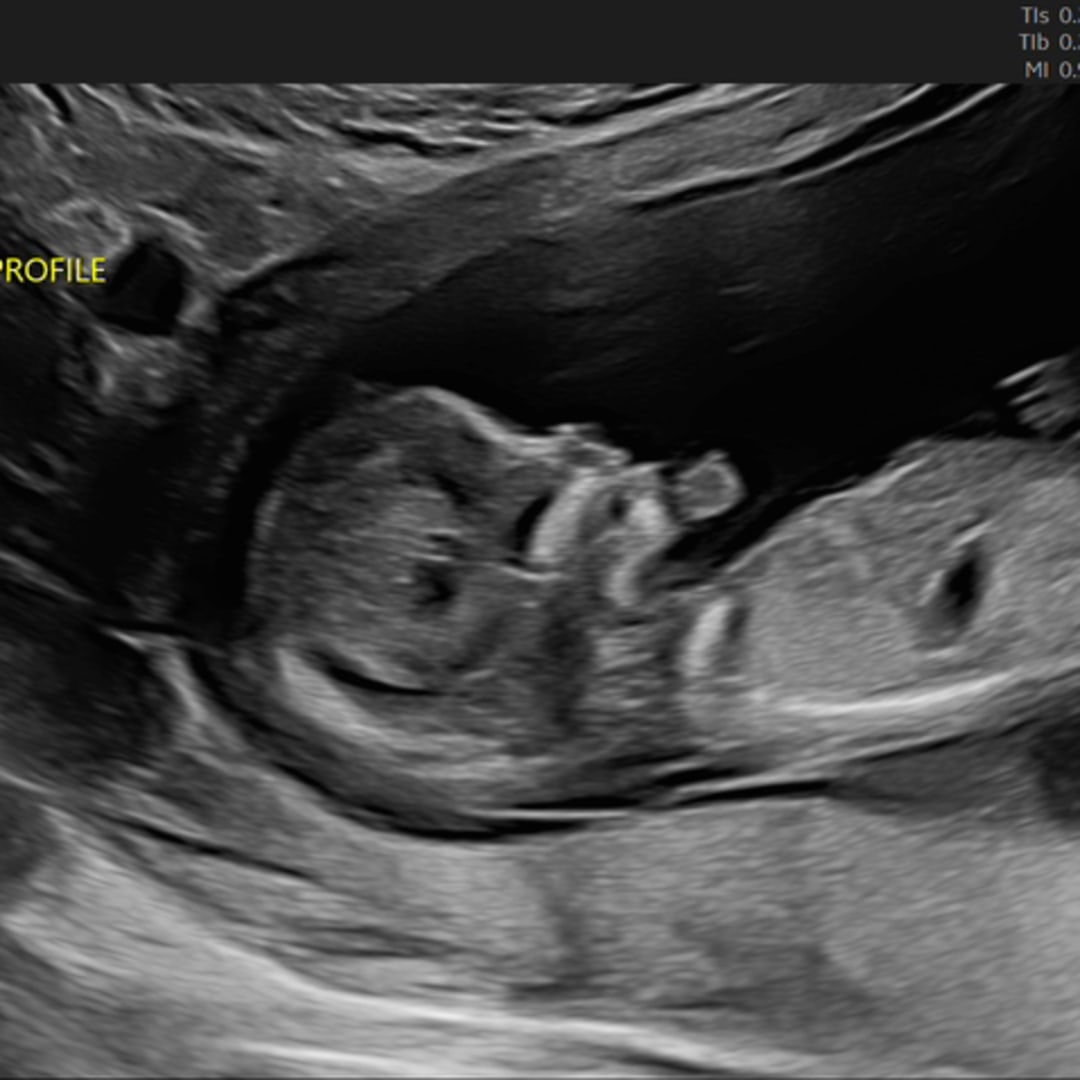 Photo shared by Stephen for their Babylist baby registry.