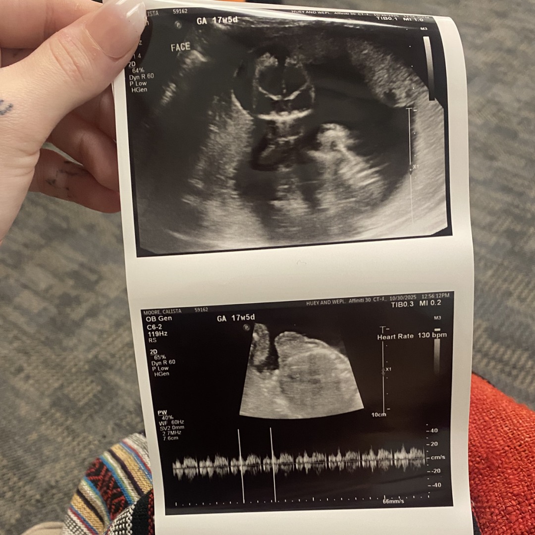 Photo shared by Calista for their Babylist baby registry.