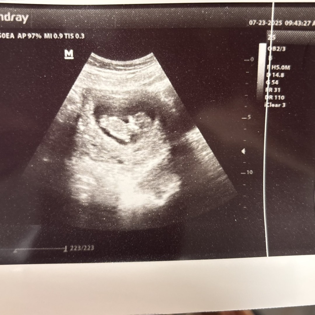 Photo shared by Katy for their Babylist baby registry.