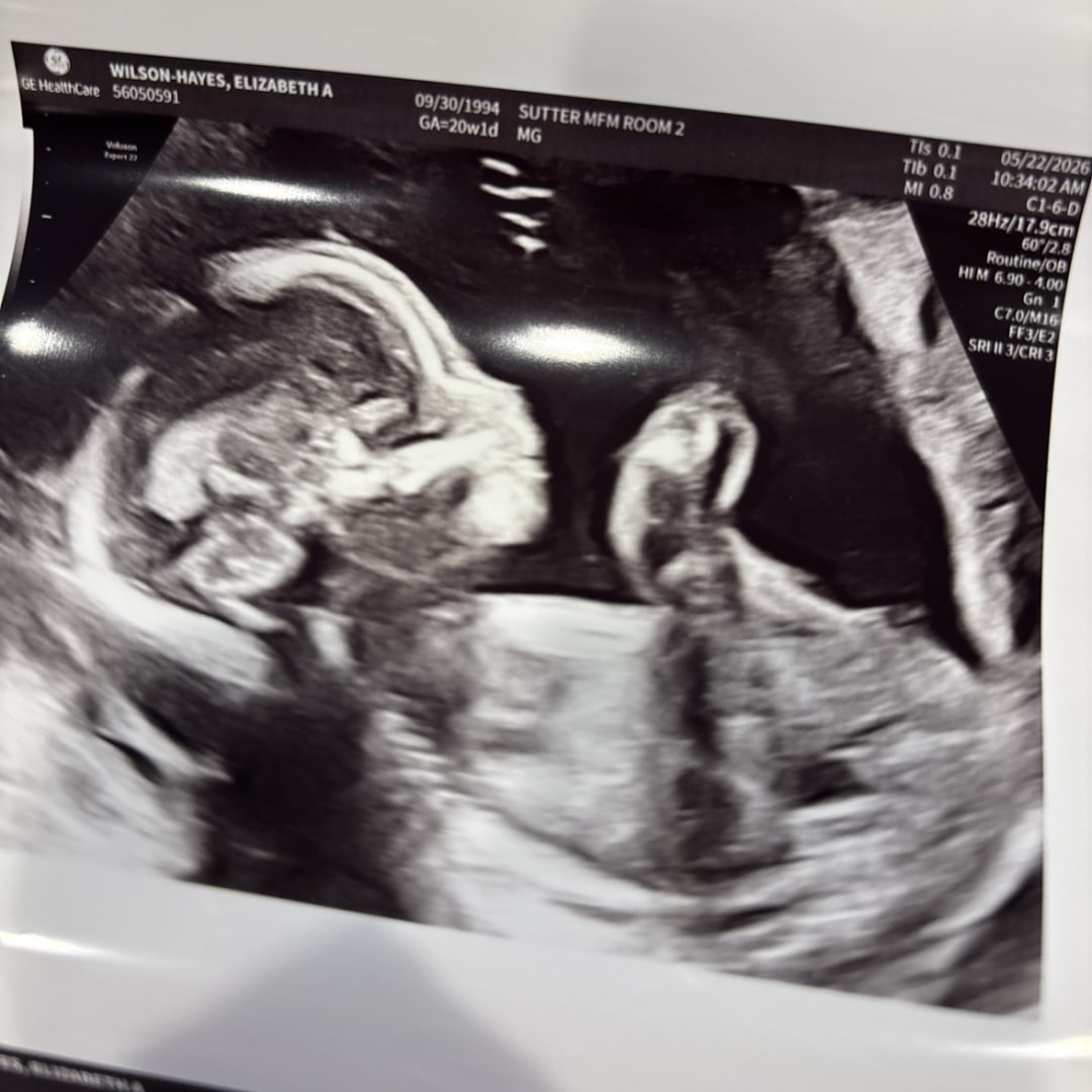 Photo shared by Beth for their Babylist baby registry.