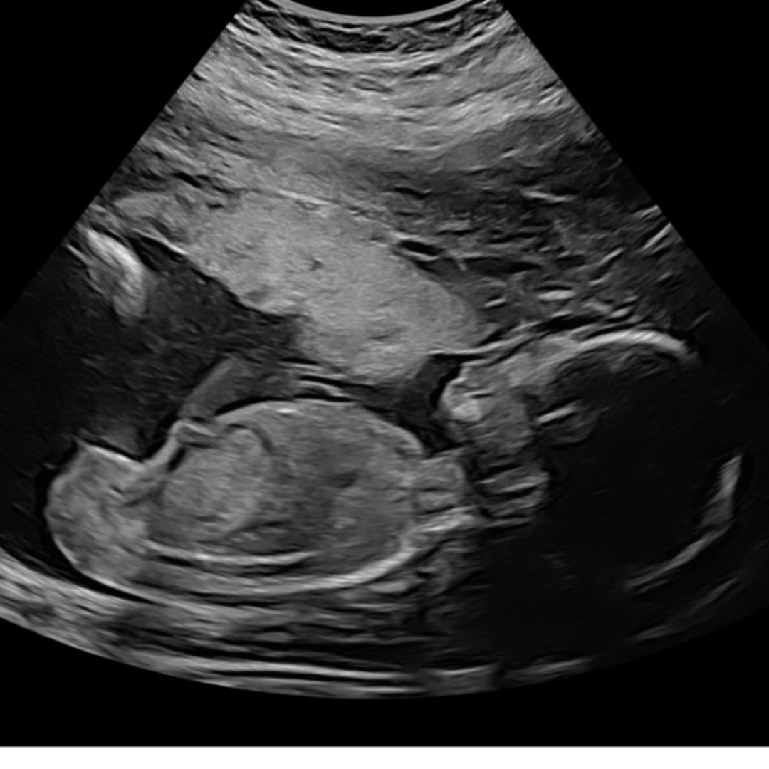 Photo shared by Leilani for their Babylist baby registry.