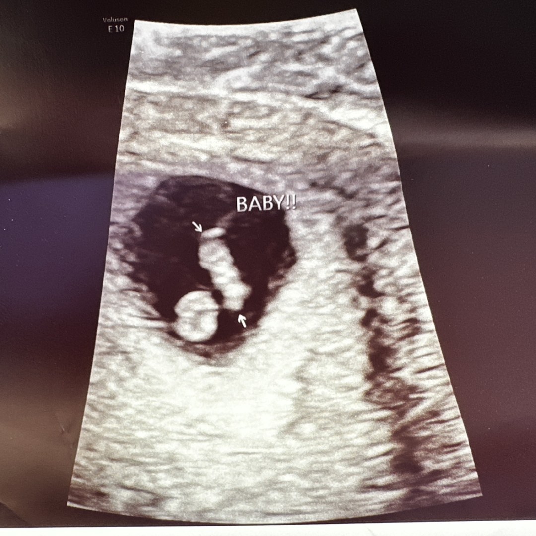 Photo shared by Amanda for their Babylist baby registry.