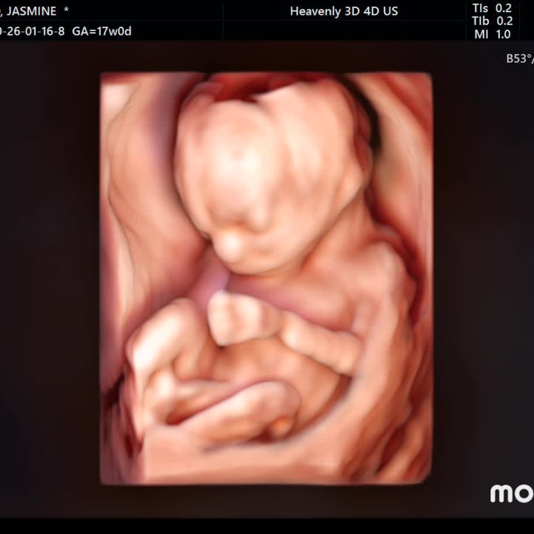 Photo shared by Jasmin for their Babylist baby registry.