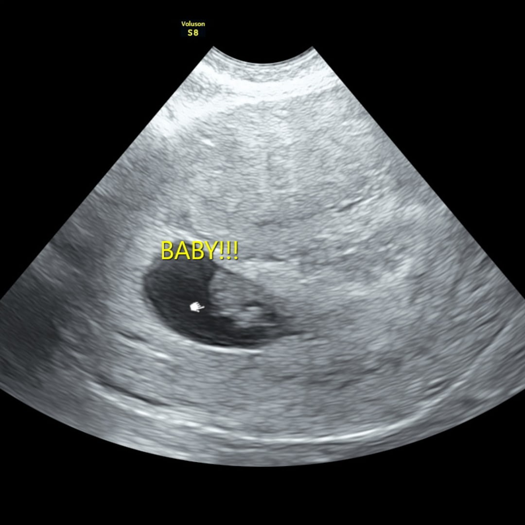 Photo shared by Brittany for their Babylist baby registry.