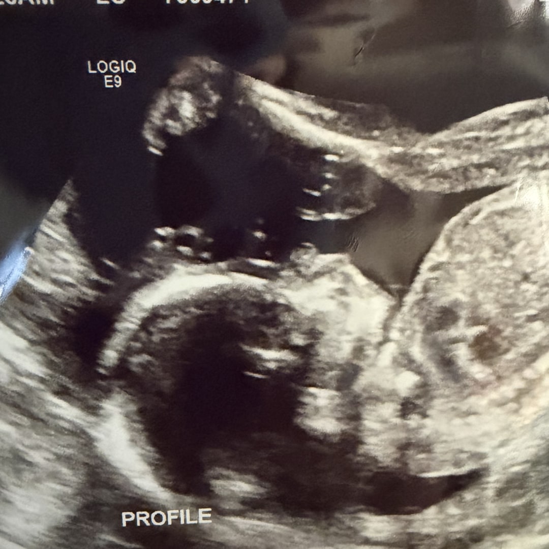 Photo shared by Hannah for their Babylist baby registry.