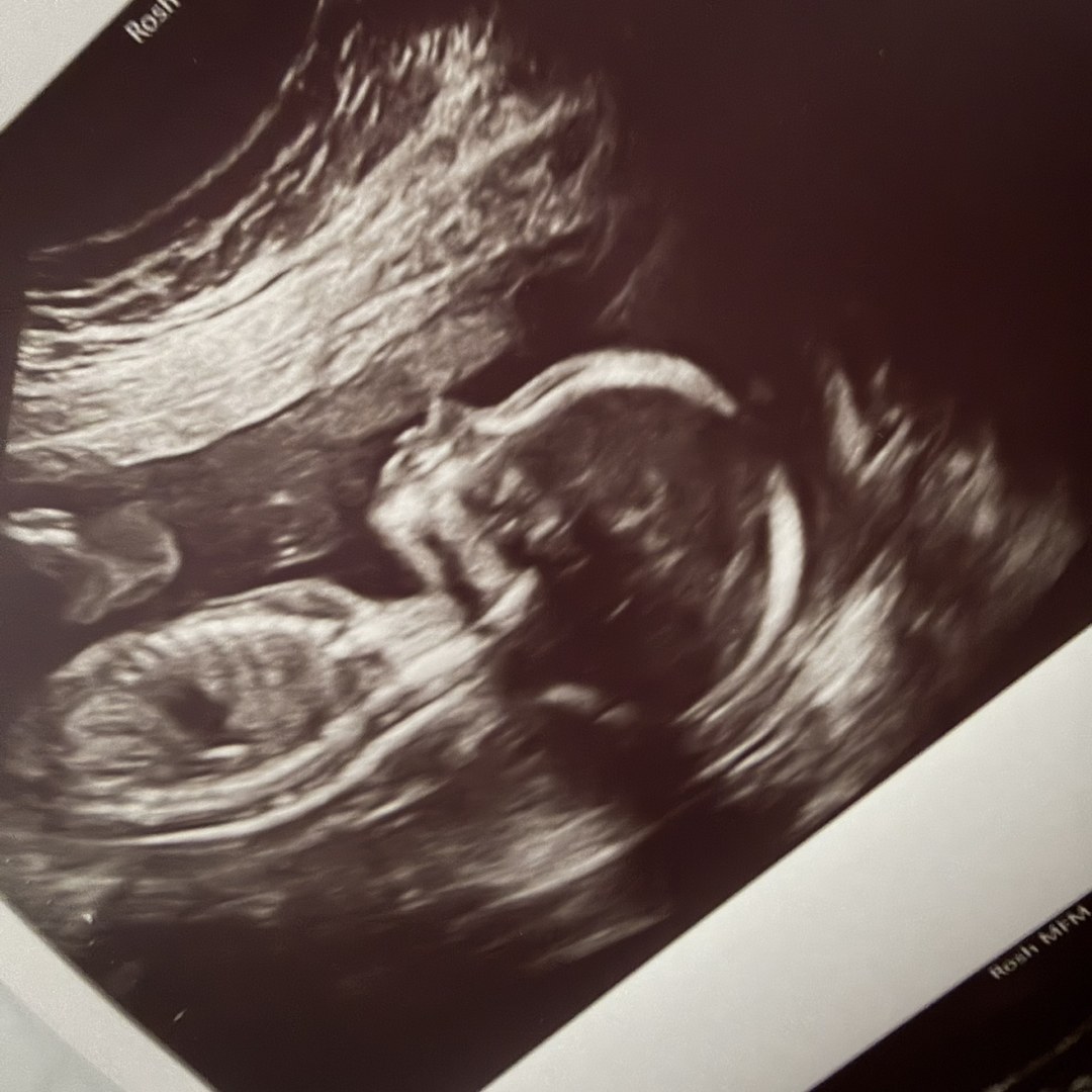 Photo shared by Nichole for their Babylist baby registry.