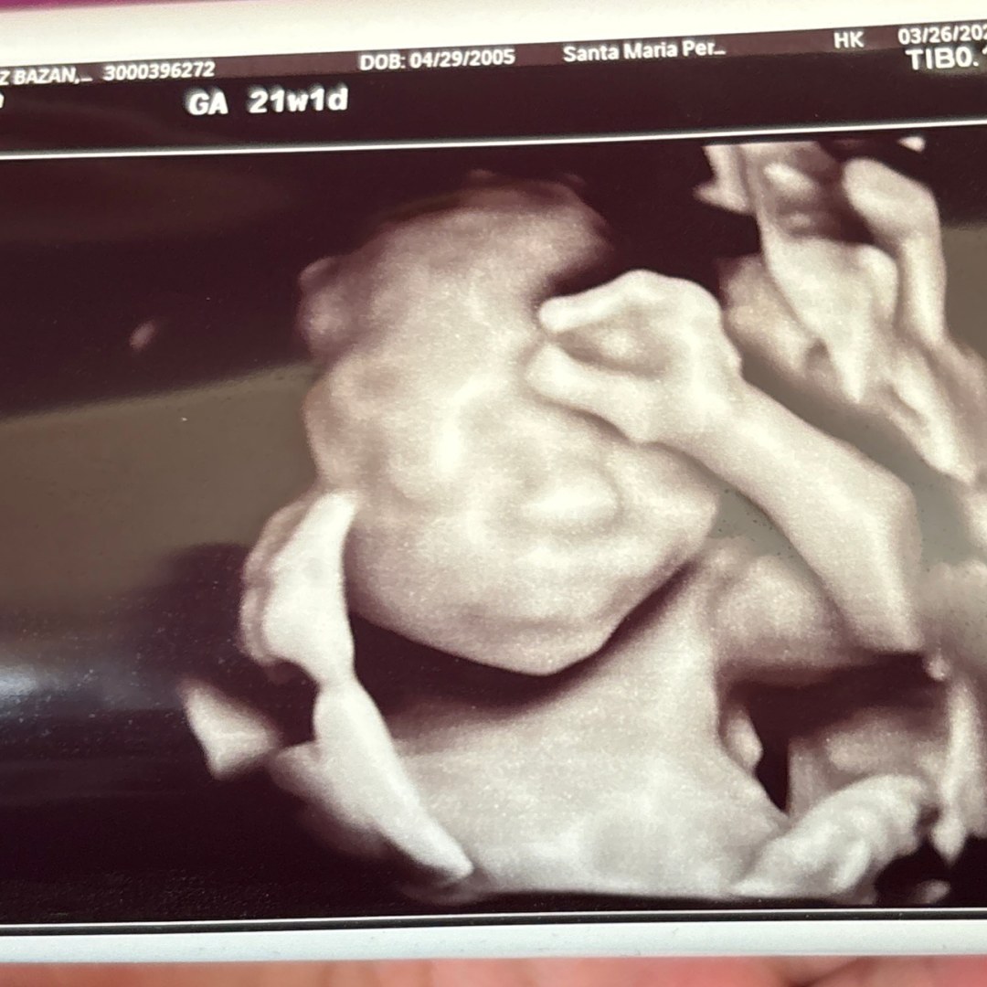 Photo shared by Eileen for their Babylist baby registry.