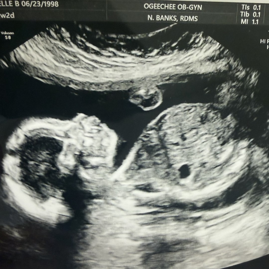 Photo shared by Anabelle for their Babylist baby registry.