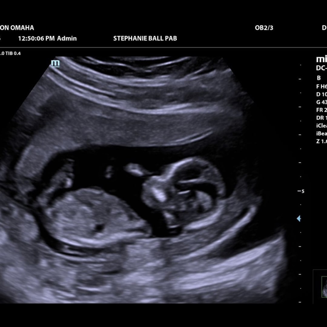 Photo shared by Stephanie for their Babylist baby registry.