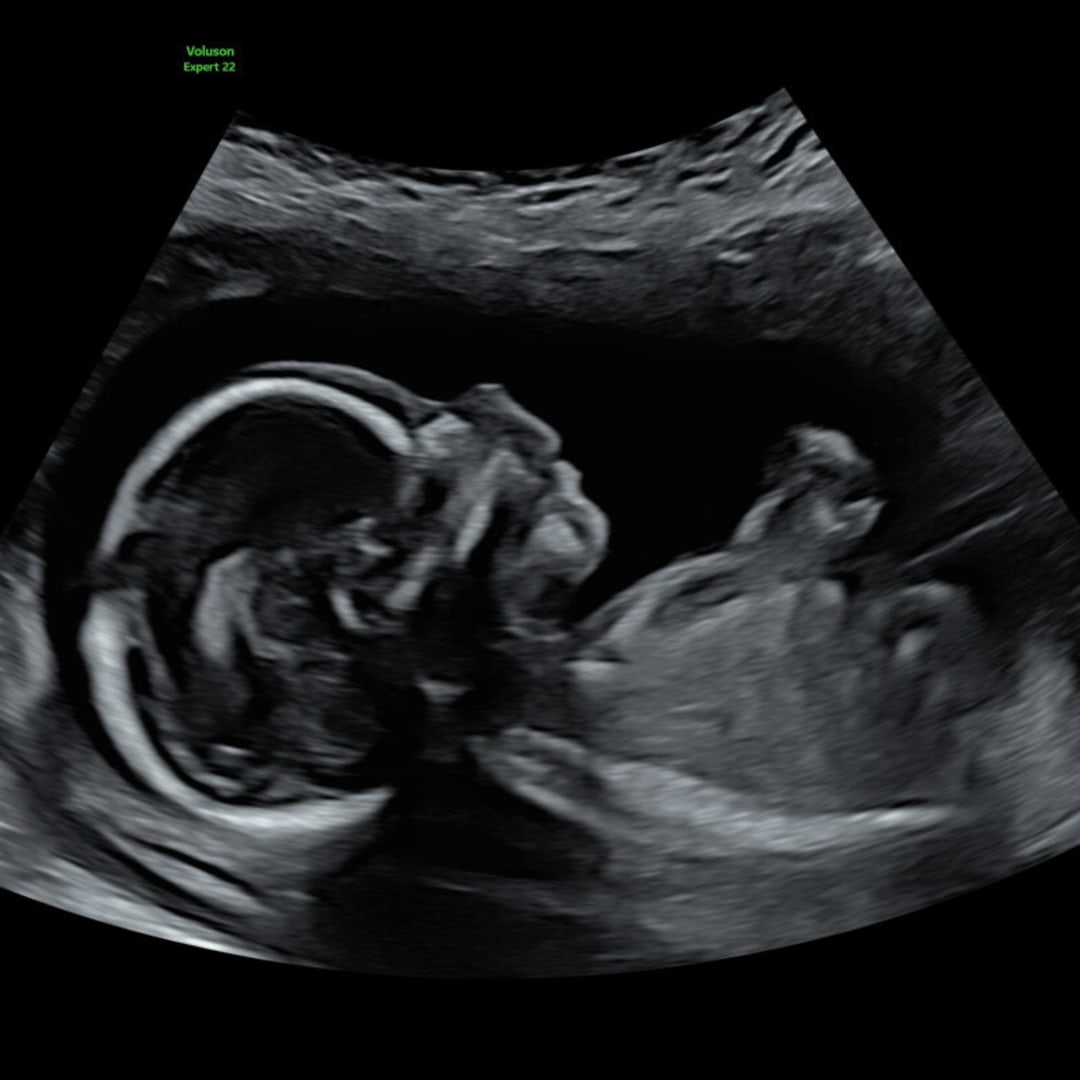Photo shared by Ceilidhe for their Babylist baby registry.