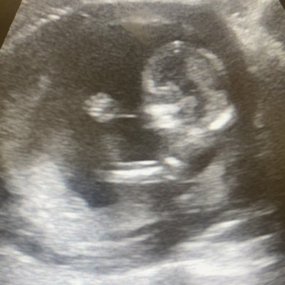 Photo shared by Karli for their Babylist baby registry.