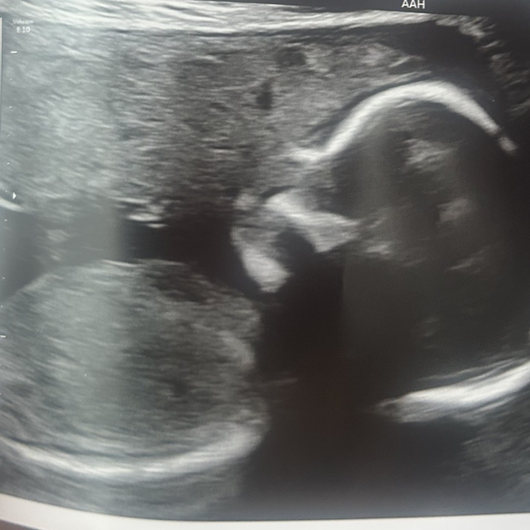 Photo shared by Maya for their Babylist baby registry.