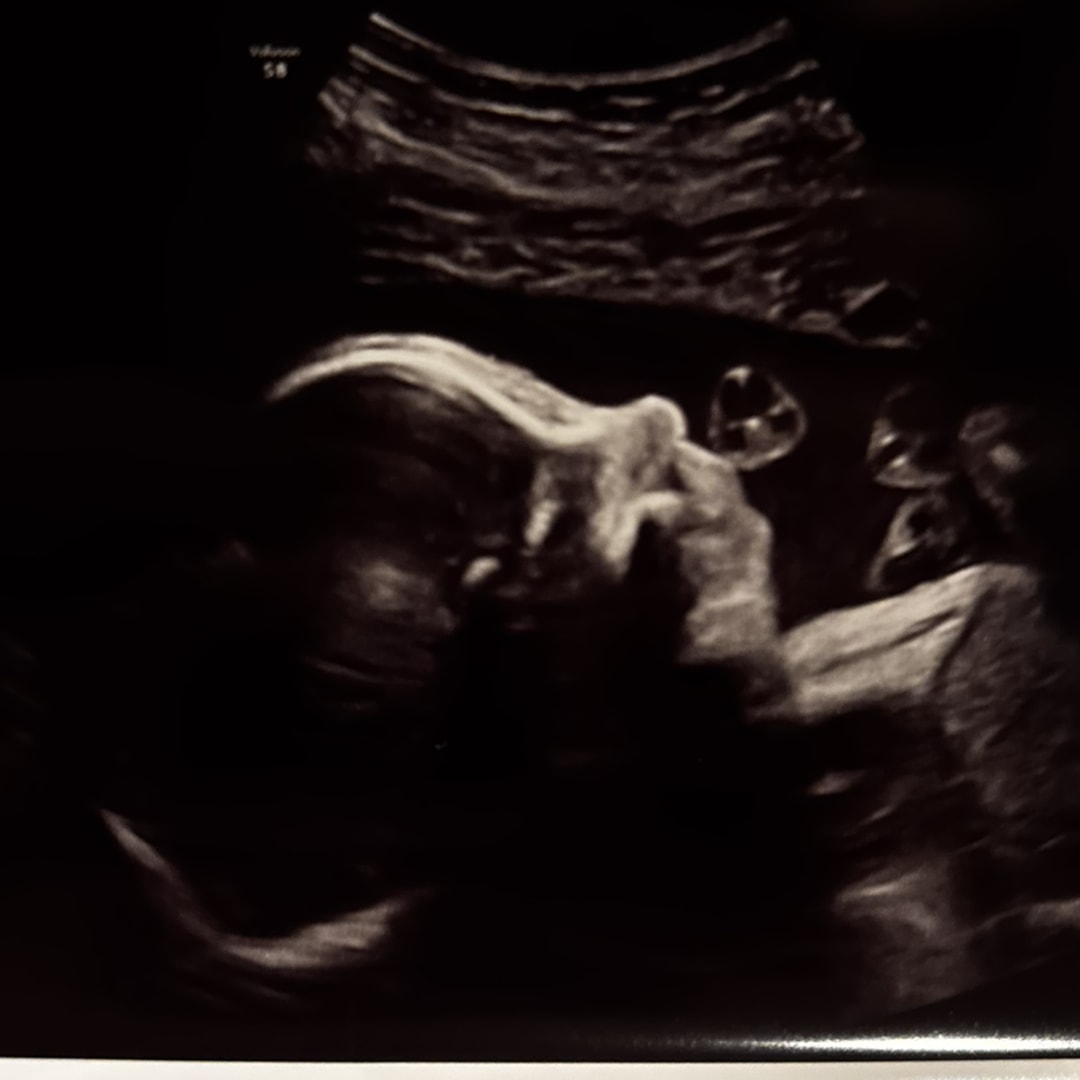 Photo shared by Athena for their Babylist baby registry.