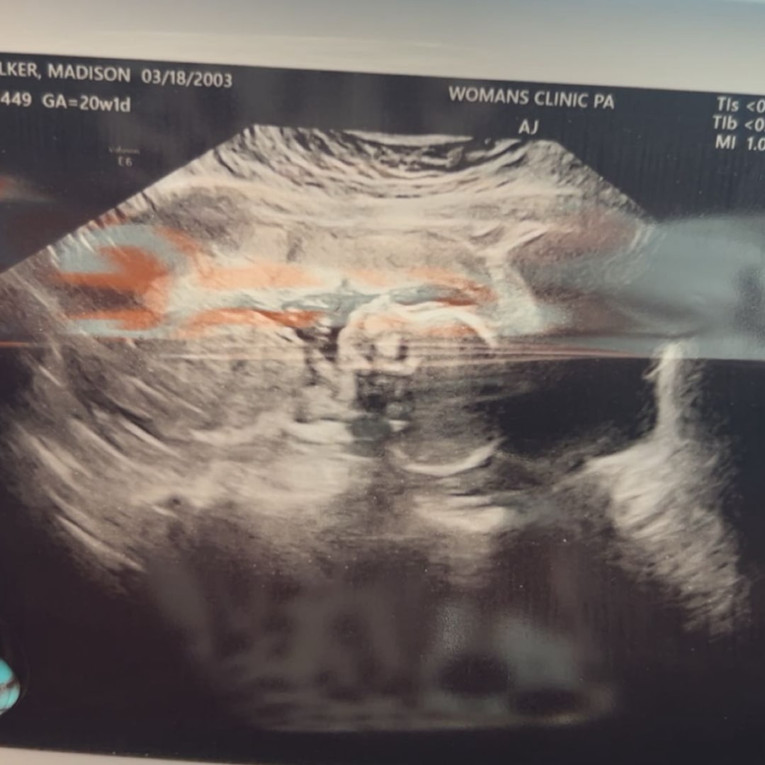 Photo shared by Madison for their Babylist baby registry.