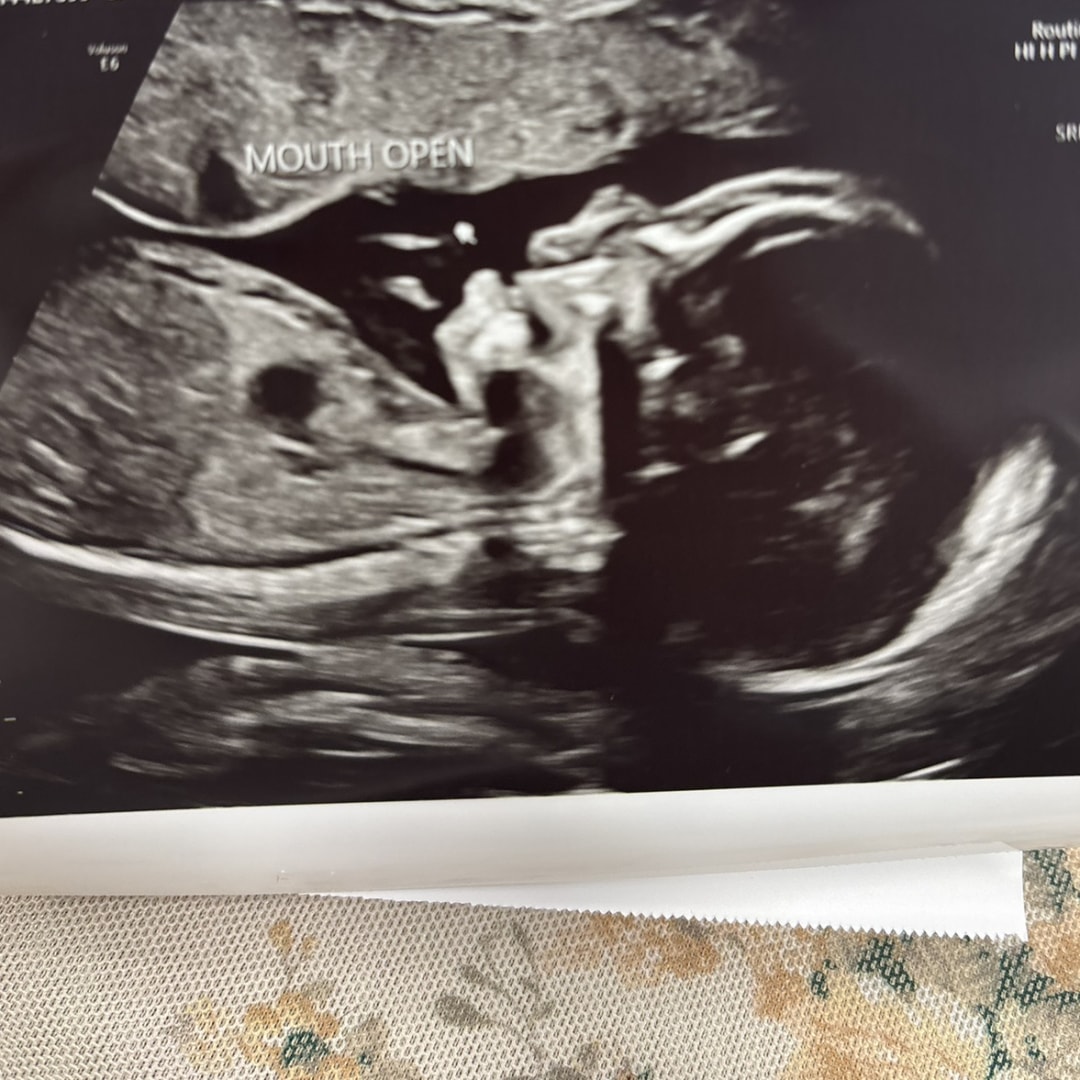 Photo shared by Karla for their Babylist baby registry.