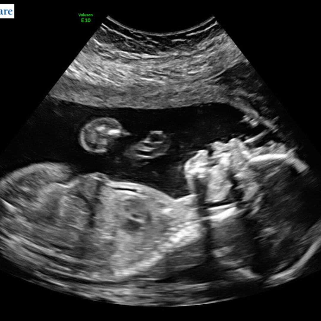 Photo shared by Avery for their Babylist baby registry.