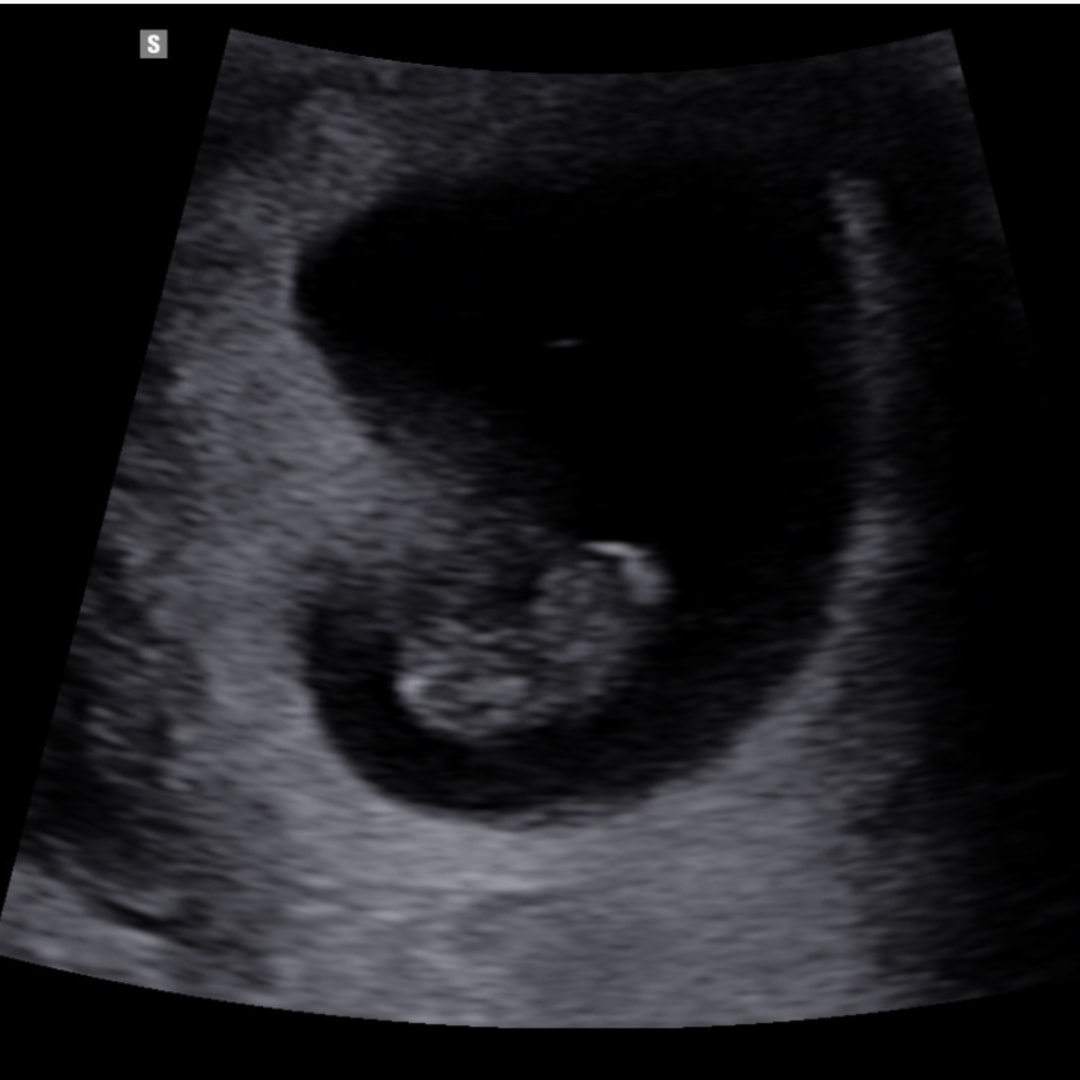 Photo shared by Zakihya for their Babylist baby registry.