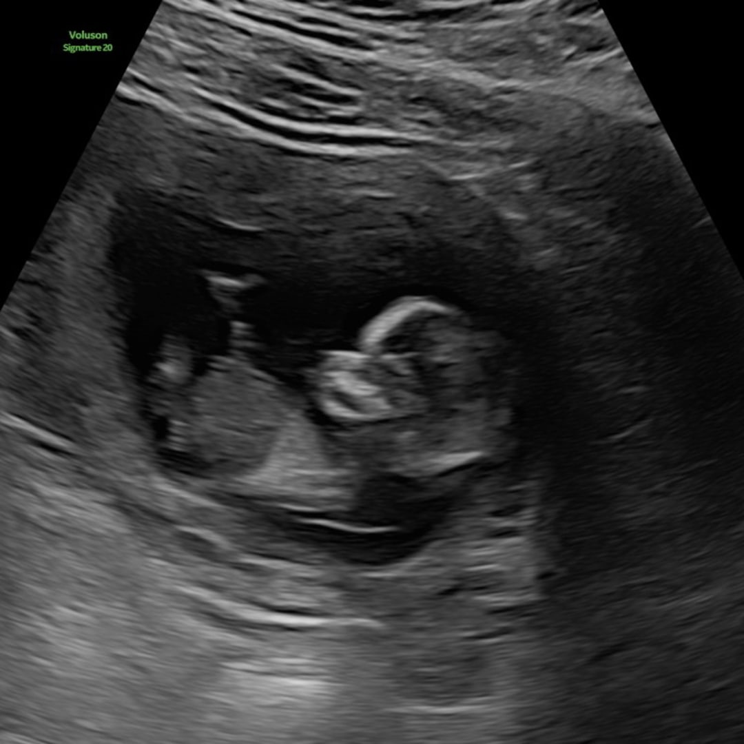 Photo shared by Jasmen for their Babylist baby registry.