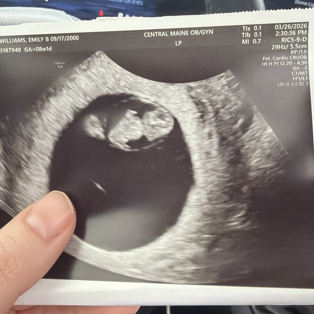 Photo shared by Emily for their Babylist baby registry.