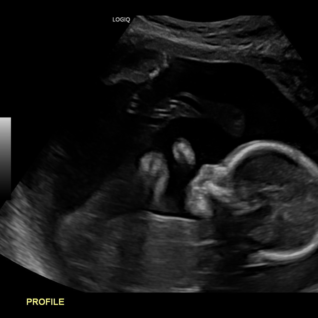 Photo shared by Kelly for their Babylist baby registry.