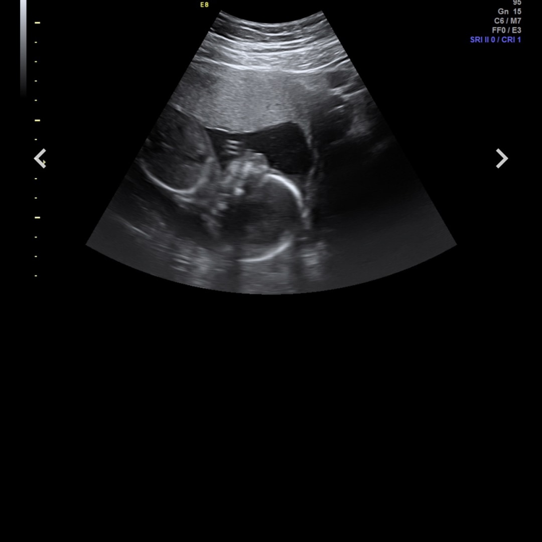 Photo shared by Erika for their Babylist baby registry.