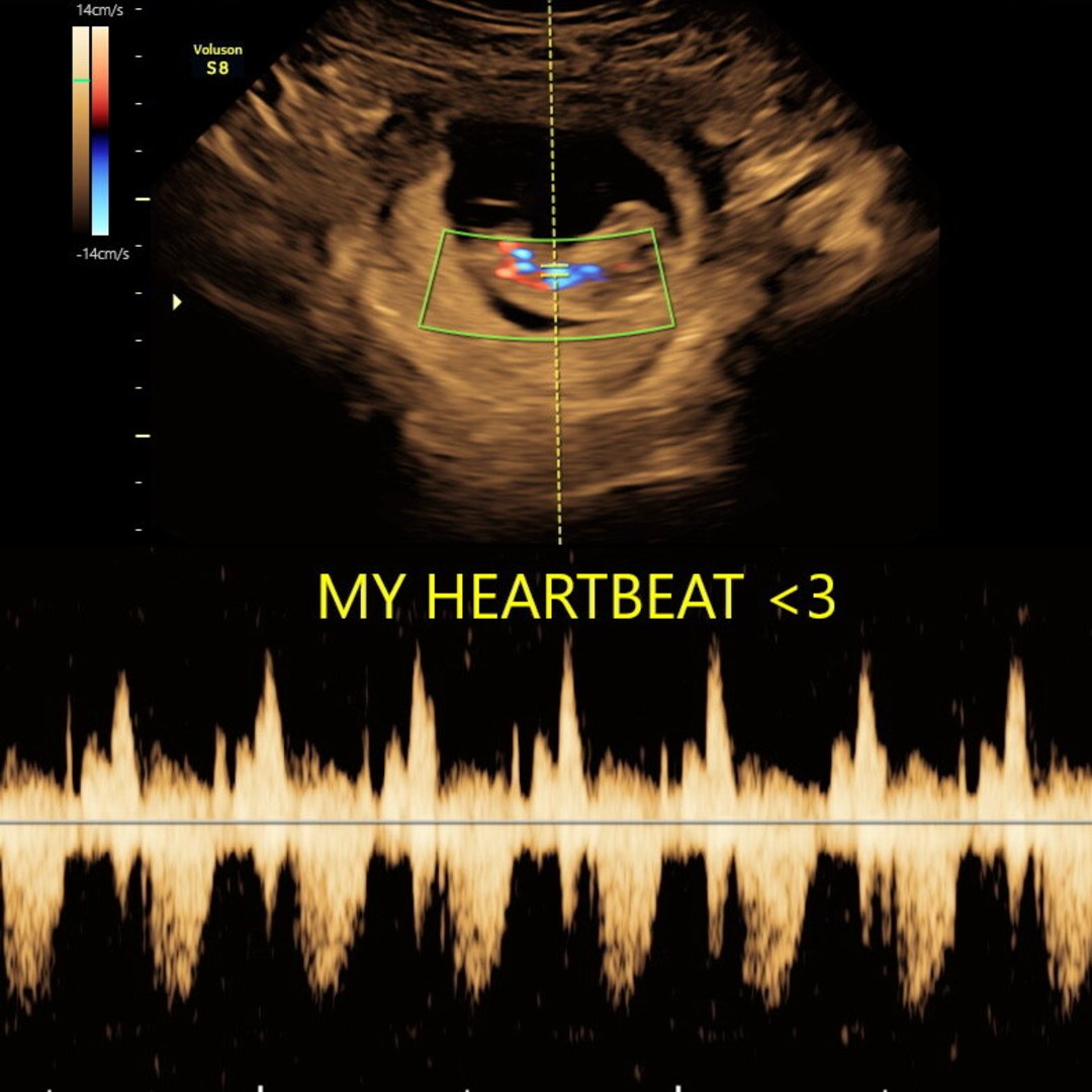 Photo shared by Erin for their Babylist baby registry.