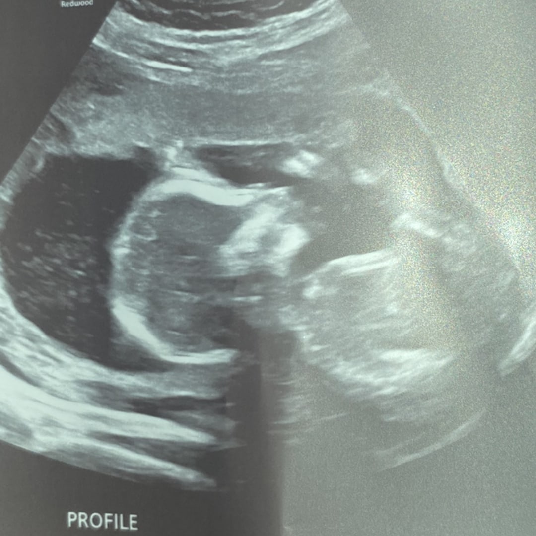 Photo shared by Tamya for their Babylist baby registry.