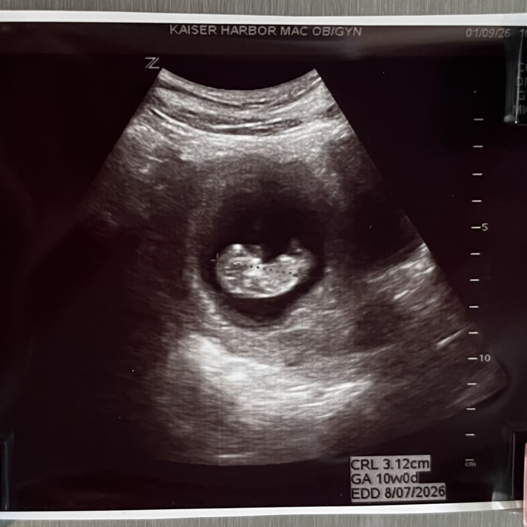 Photo shared by Sam for their Babylist baby registry.