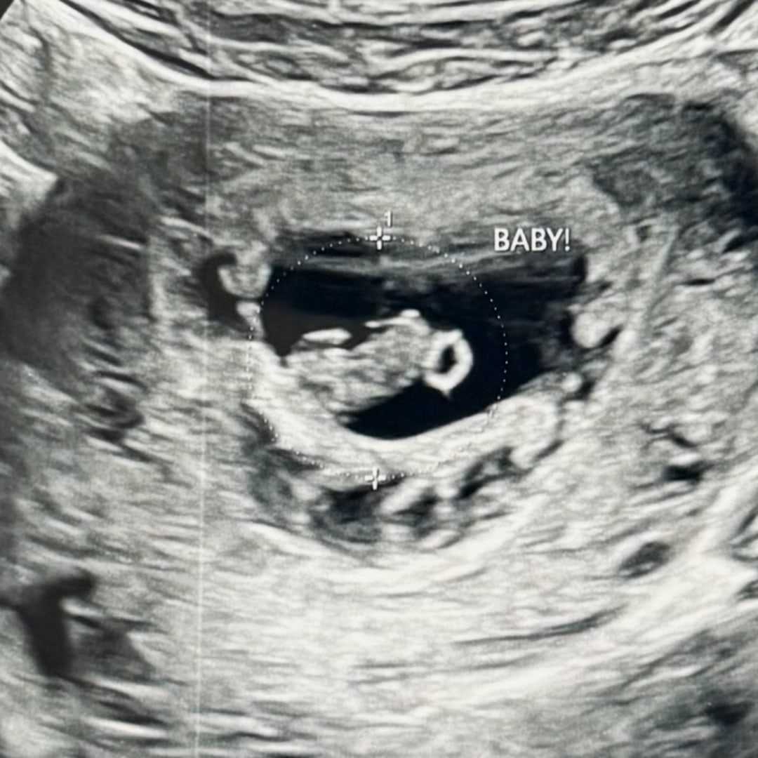 Photo shared by Cylie for their Babylist baby registry.