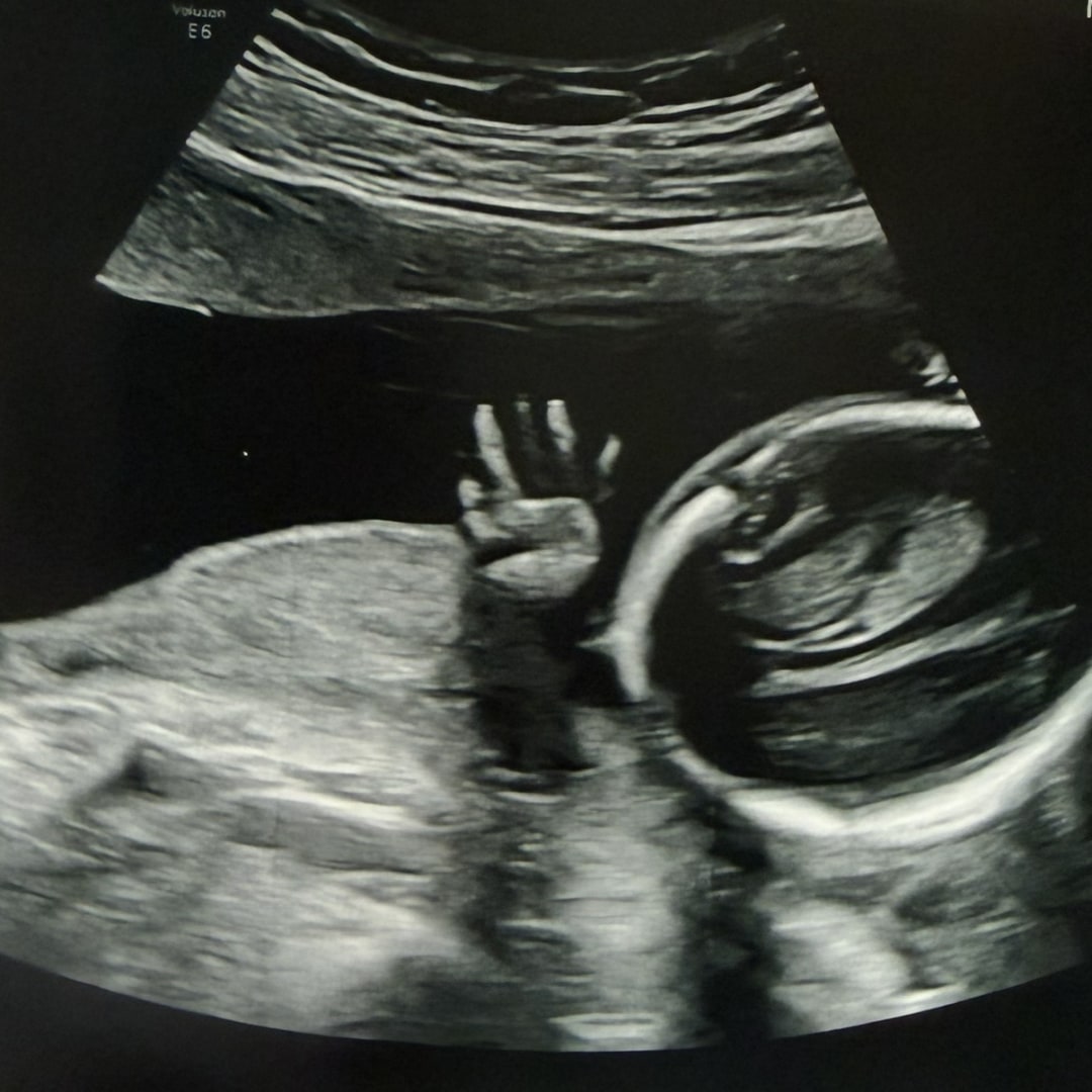 Photo shared by Anna Katherynn for their Babylist baby registry.