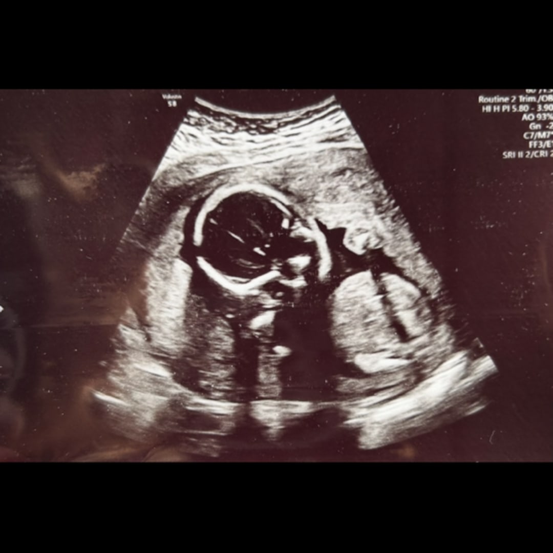 Photo shared by Yesenia for their Babylist baby registry.