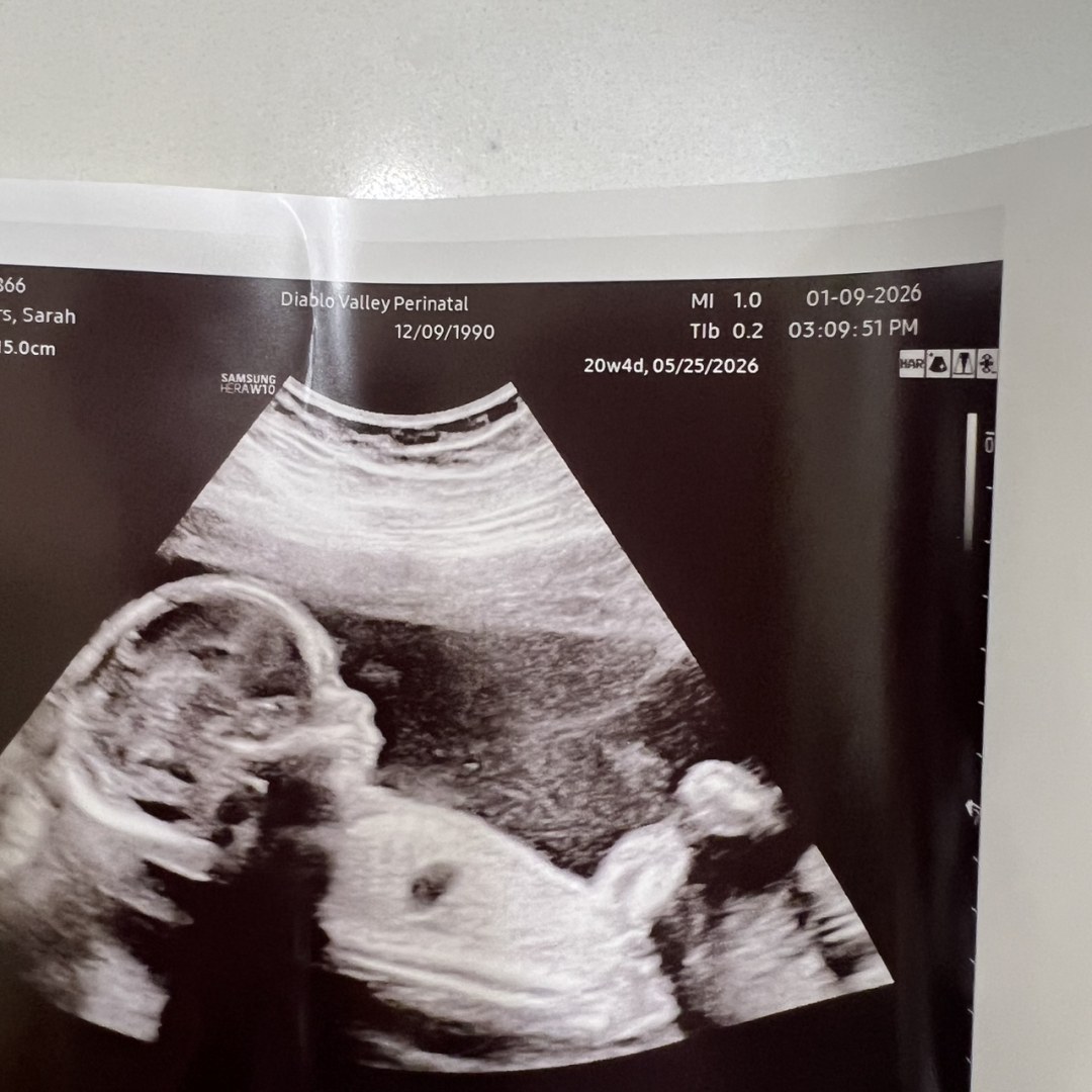 Photo shared by Sarah for their Babylist baby registry.