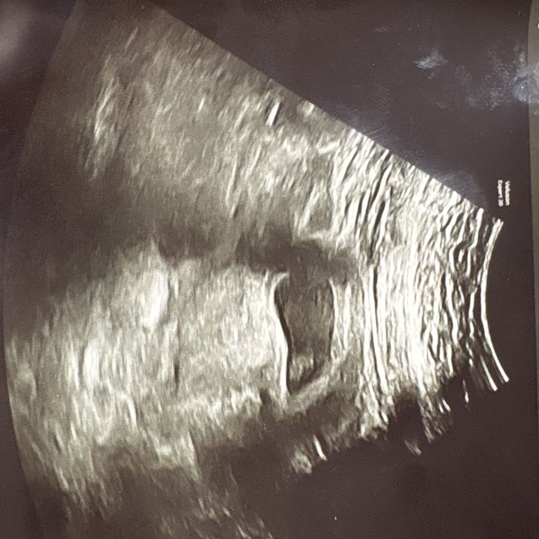 Photo shared by Haley for their Babylist baby registry.