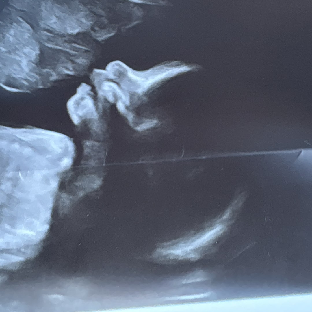 Photo shared by Gabrielle for their Babylist baby registry.