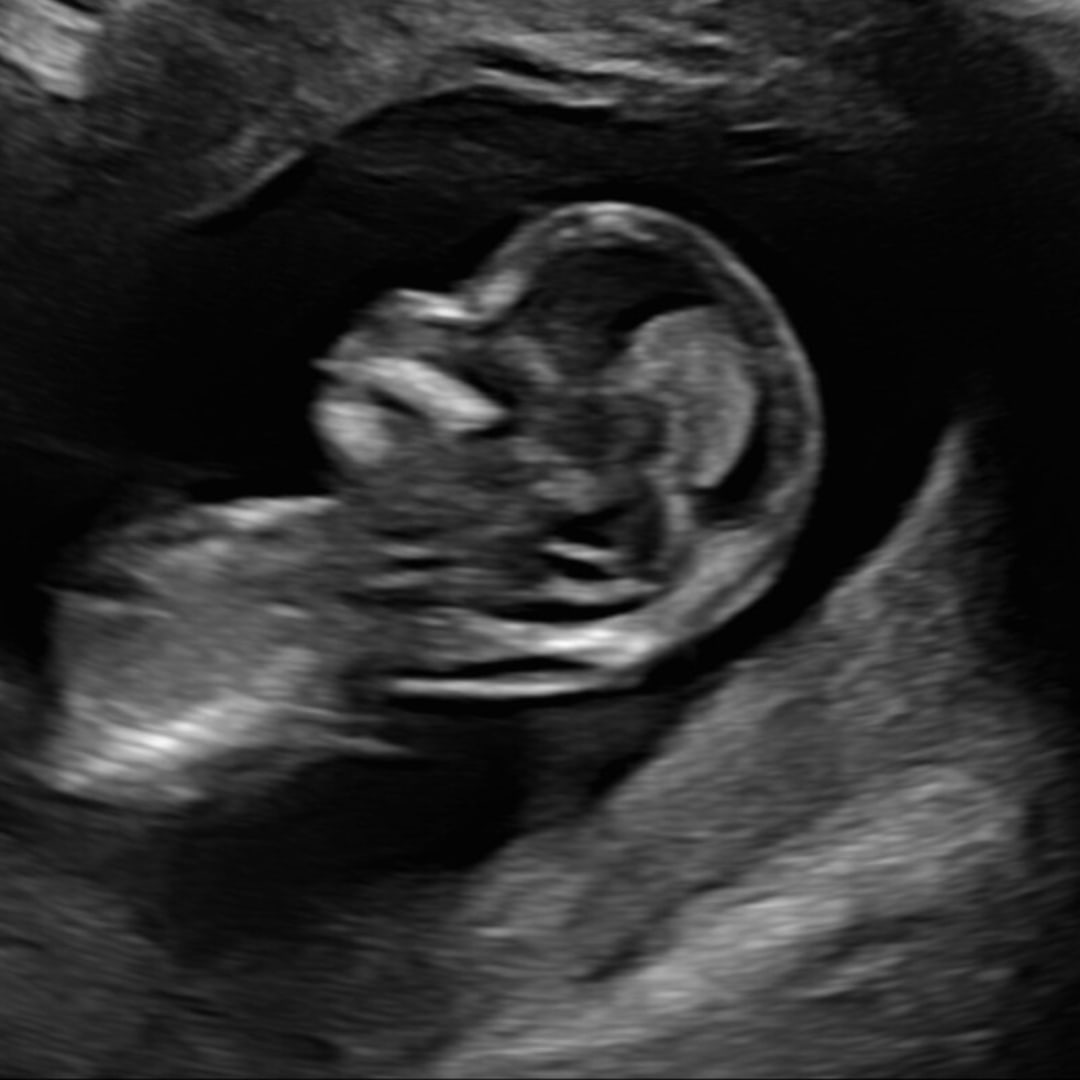 Photo shared by Carlie for their Babylist baby registry.