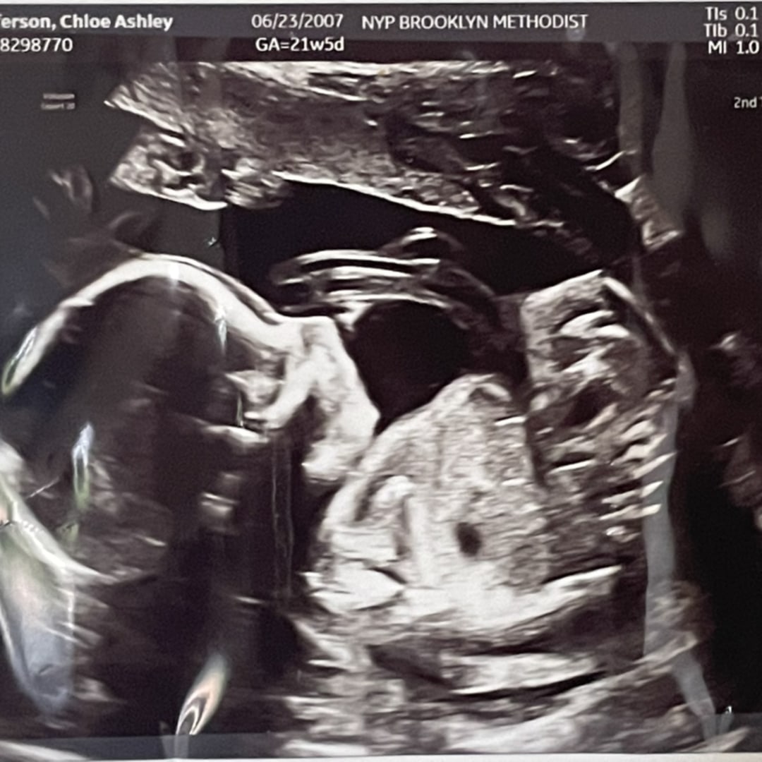 Photo shared by Chloe for their Babylist baby registry.