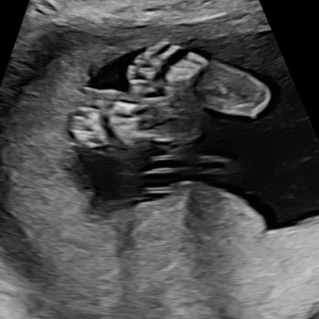 Photo shared by Michelle for their Babylist baby registry.