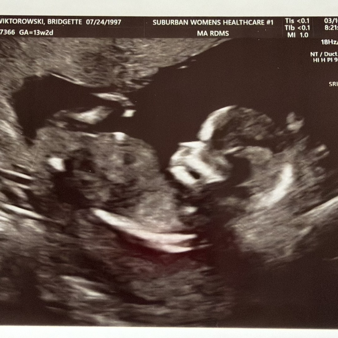 Photo shared by Bridgette and Brian for their Babylist baby registry.