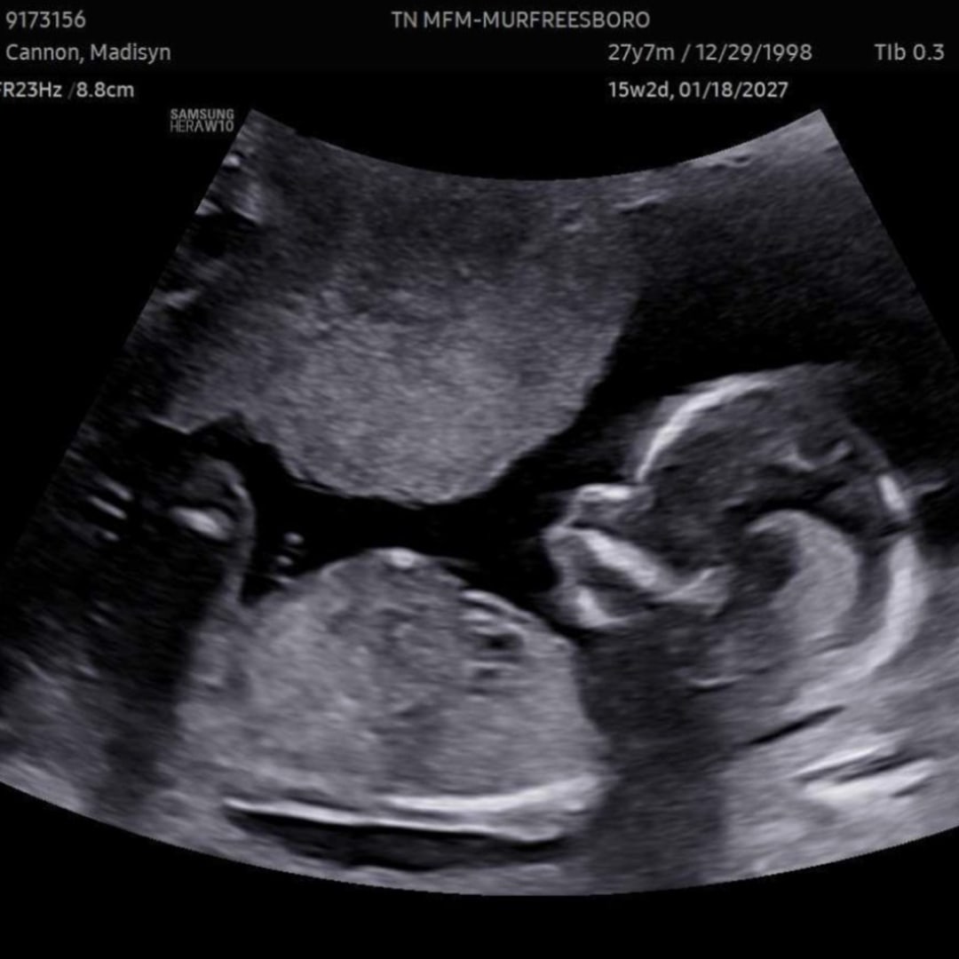 Photo shared by Madisyn for their Babylist baby registry.