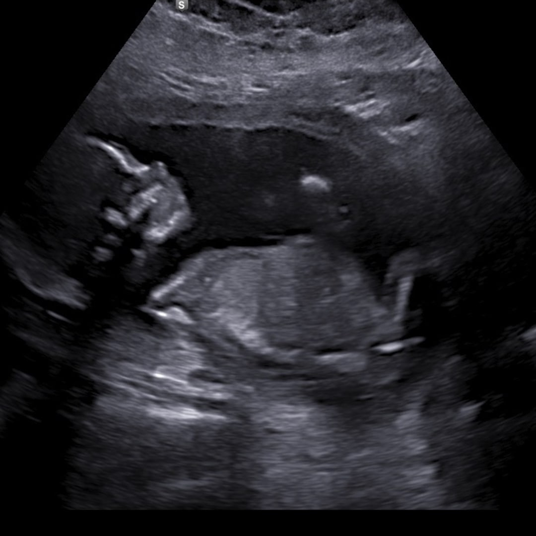 Photo shared by Carmen for their Babylist baby registry.