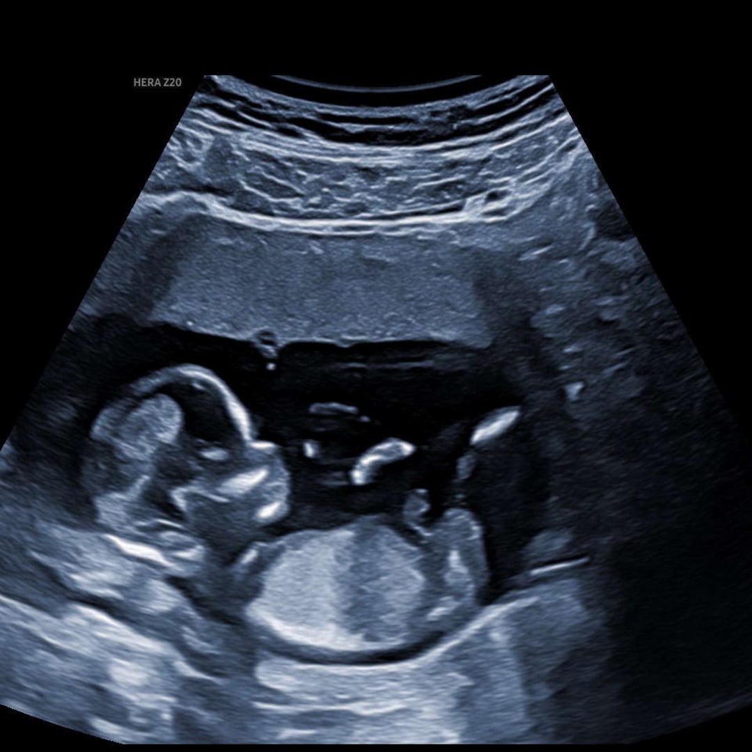 Photo shared by Shanise for their Babylist baby registry.