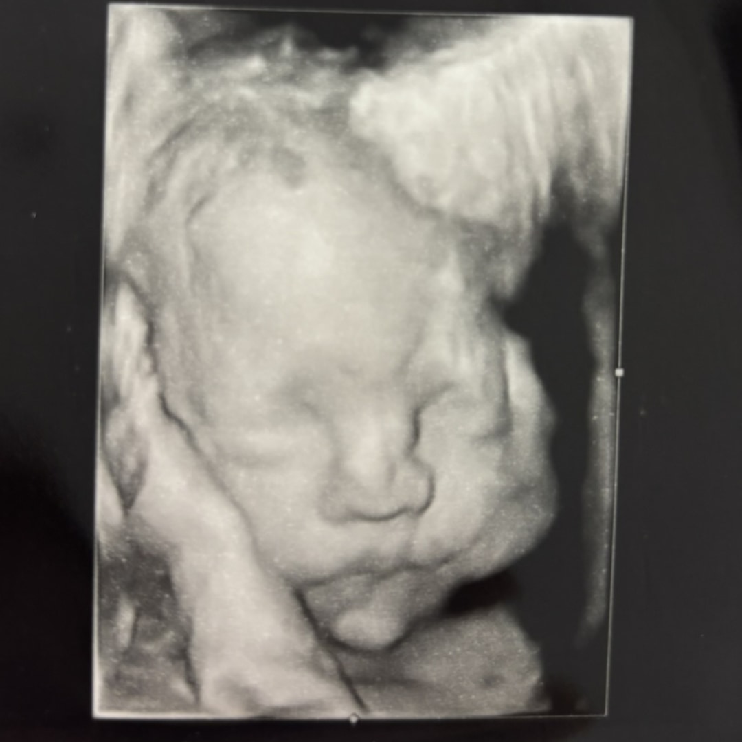 Photo shared by Gladys for their Babylist baby registry.