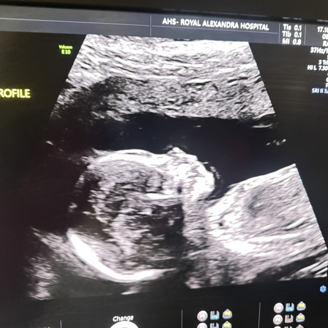 Photo shared by Kristel for their Babylist baby registry.