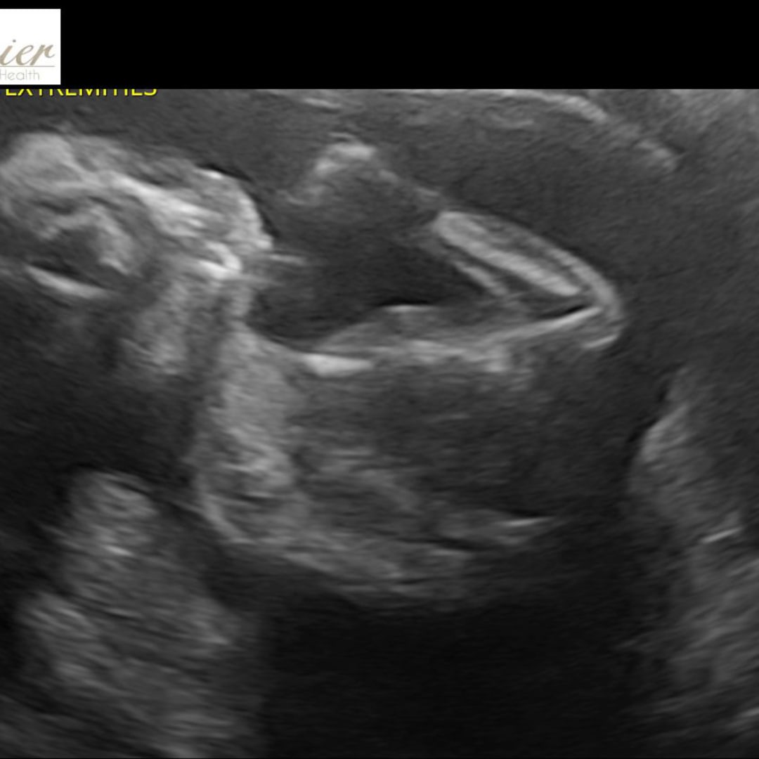 Photo shared by Brooke for their Babylist baby registry.