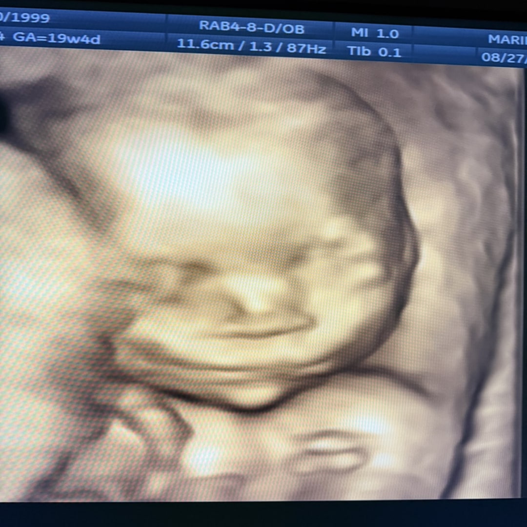 Photo shared by Maria for their Babylist baby registry.