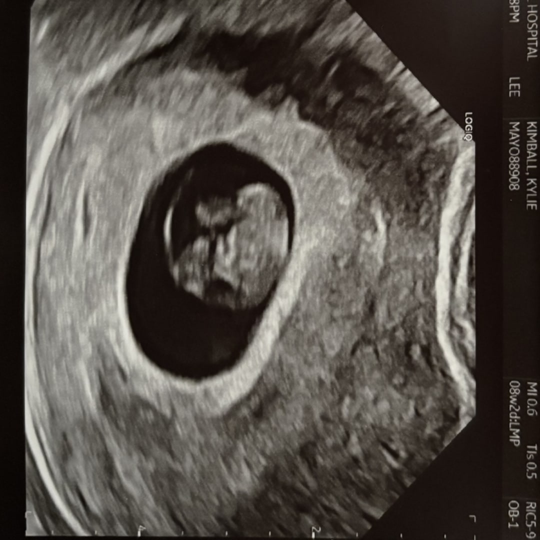 Photo shared by Kylie for their Babylist baby registry.