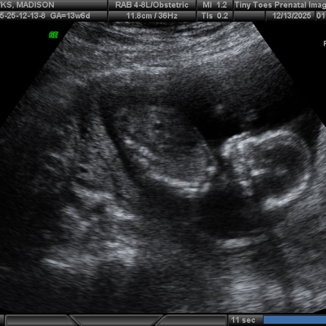 Photo shared by Madison for their Babylist baby registry.